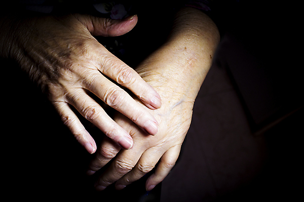 포토 JPG 해외이미지 손 여자 백그라운드 이동 컨셉 손가락 건강 사람 성인 사람없음 치료 운동 약 건강관리 스트레칭 고통 터치 환자 마사지 질병 장애인 연습 서비스 잠금 테라피 장애 돌봄 물리치료 물리치료사 옛날 지원 헬프 해외포토 감정 의학 모션 관리 신체부위 뷰티 도움 보안 치료사 파일형식 이미지허브