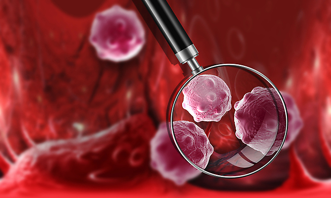 포토 JPG 해외이미지 일러스트 돋보기 세포 건강 사람없음 파란색 3D 디지털 만들기 암 박테리아 종양 해외일러스트 컬러 의학 모션 질병 디지털합성 파일형식 이미지허브