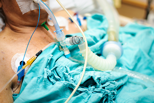 포토 JPG 해외이미지 직업 손 여자 과학 신체 건강 병원 실험 사람 동양인 성인 사람없음 약 방 장비 환자 간호사 의사 기구 도움 가르침 호흡기관 호흡 질병 간호 서비스 튜브 외과 병실 80대 환풍기 돌봄 인공 해외포토 교육 노년 컨셉 의학 모션 인종 신체부위 의료진 장기_의학 파일형식 이미지허브