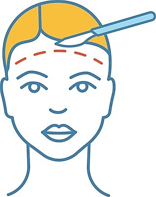 EPS 해외이미지 클립아트 모양 디자인 여자 얼굴 컨셉 신체 일러스트 병원 치료 파란색 뷰티 약 웹 화장품 환자 수술 플라스틱 만화 하락 가득함 심볼 피부 서비스 그림 윤곽 외과 순서 고립 돌봄 리프팅 절개 스타일 해외일러스트 컬러 인터넷 의학 모션 재질 사람 신체부위 파일형식 벡터 이미지허브