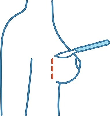 EPS 해외이미지 클립아트 모양 디자인 여자 신체 일러스트 병원 치료 파란색 뷰티 약 웹 화장품 환자 수술 플라스틱 가슴 만화 가득함 심볼 피부 서비스 그림 윤곽 외과 순서 고립 궤 돌봄 실리콘 절개 스타일 해외일러스트 컬러 인터넷 의학 모션 재질 사람 신체부위 파일형식 벡터 이미지허브