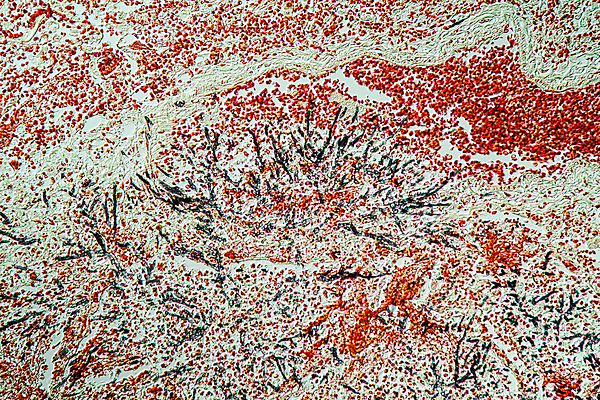 포토 JPG 해외이미지 과학 사람없음 치료 약 확대 질병 작음 곰팡이 에이즈 이스트 해외포토 의학 크기 파일형식 이미지허브