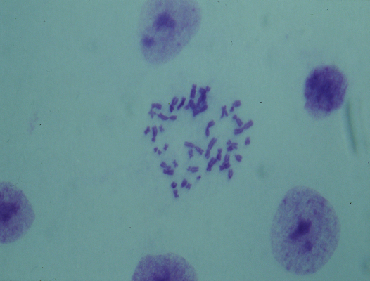 포토 JPG 해외이미지 세포 사람 사람없음 약 보라색 시험 의사 확대 질병 DNA 제비꽃 염색체 분할 해외포토 교육 꽃 컬러 의학 의료진 생명공학 파일형식 이미지허브
