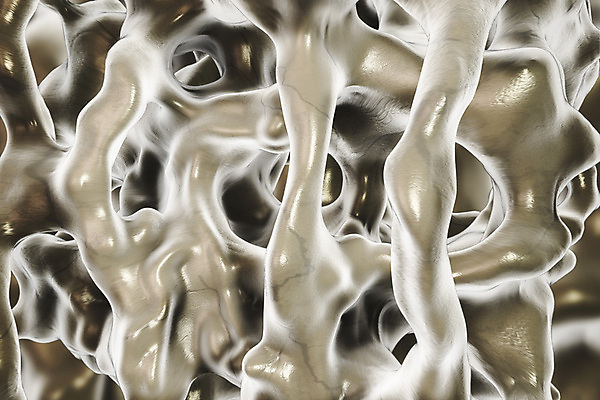 포토 JPG 해외이미지 일러스트 뼈 골격 현미경 사람없음 컬러풀 약 3D 질병 척추 골다공증 현실 해외일러스트 컬러 의학 실험기구 디지털합성 파일형식 이미지허브