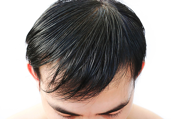 포토 JPG 해외이미지 헤어스타일 응시 남자 백그라운드 컨셉 건강 한명 사람 성인 치료 머리 성장 흰색 머리빗 걱정 가발 대머리 문제 샴푸 돌봄 스타일리스트 얇은 옛날 적자 헬프 해외포토 1 시선 감정 컬러 의학 모션 신체부위 위생용품 미용용품 도움 파일형식 이미지허브