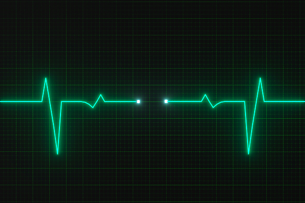 JPG 해외이미지 선 의학 사람없음 3D 검은색 바이탈사인 심전도 심전도모니터 해외포토 포토 컬러 디지털합성 파일형식 이미지허브