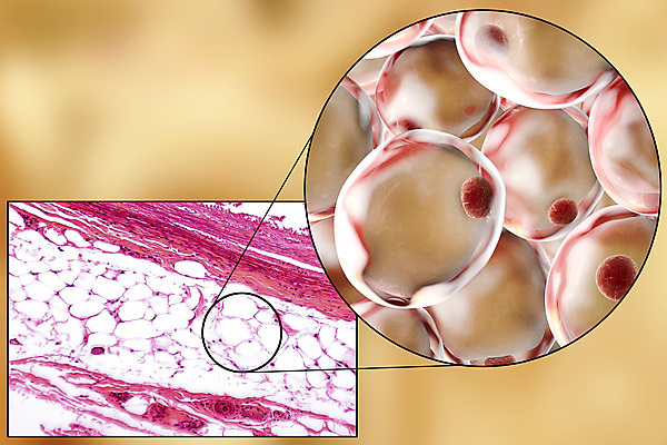 포토 JPG 해외이미지 신체 다이어트 해부 세포 현미경 사람없음 빛 3D 흰색 물방울 얼룩 조직 확대 미끄럼틀 몸무게 플라스틱 먹기 비만 피부 창고 생물학 인덱스 덩어리 셀룰러 해외포토 교육 컬러 의학 모션 재질 건강 실험기구 신체부위 놀이기구 몸매 디지털합성 파일형식 이미지허브