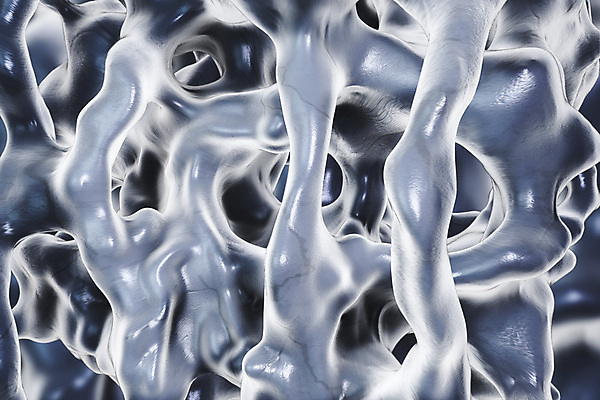 포토 JPG 해외이미지 일러스트 뼈 골격 현미경 사람없음 컬러풀 약 3D 질병 척추 골다공증 현실 해외일러스트 컬러 의학 실험기구 디지털합성 파일형식 이미지허브