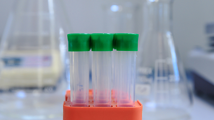 포토 JPG 해외이미지 과학 컨셉 교실 건강 병원 실험 사람없음 스터디 약 장비 도구 기술자 실험실 바이러스 선택 질병 컨테이너 플라스틱 플라스크 분석 생물학 비커 감염 미생물 유리그릇 튜브 발견 조제 혁명 개발 화학물질 화학자 살균 해외포토 직업 그릇 교육 산업 의학 학교 유리 재질 생물 실험기구 학습 화학 과학자 만들기 파일형식 이미지허브