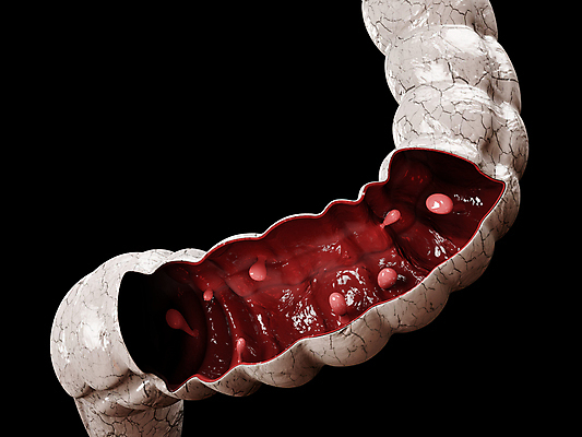 포토 JPG 해외이미지 과학 신체 일러스트 부분 해부 세포 건강 사람 사람없음 그래픽 치료 약 환자 막대기 오르간 유연 그림 생물학 시스템 섬유 암 외과 테라피 삭제 방사선 종양 가상 해외일러스트 교육 의학 병원 뷰티 직물 건반악기 질병 파일형식 이미지허브