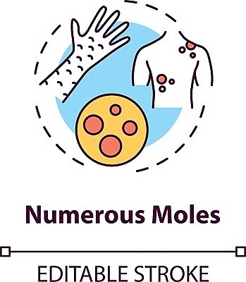 EPS 해외이미지 컨셉 사람없음 점 피부 암 피부병 해외일러스트 신체부위 질병 피부질환 파일형식 벡터 이미지허브