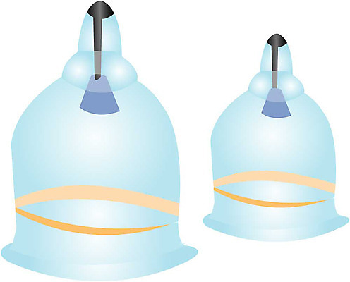 EPS 아이콘 의학 의료기기 사람없음 치료 의료용품 오브젝트 부항 한방용품 2D아이콘 파일형식 벡터