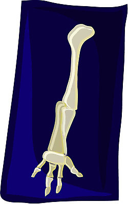 EPS 클립아트 일러스트 뼈 엑스레이 사람없음 의료용품 장기 근골격기관 오브젝트 팔 팔뼈 국내일러스트 신체 의학 의료기기 신체부위 장기_의학 파일형식 벡터