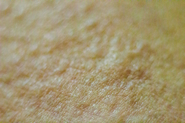 포토 JPG 해외이미지 신체 건강 사람 사람없음 빨간색 약 고통 추위 의사 대접 질병 피부 질감 오르기 감염 로션 알레르기 반응 심각 전염병 해외포토 감정 컬러 컨셉 의학 모션 신체부위 화장품 의료진 파일형식 이미지허브