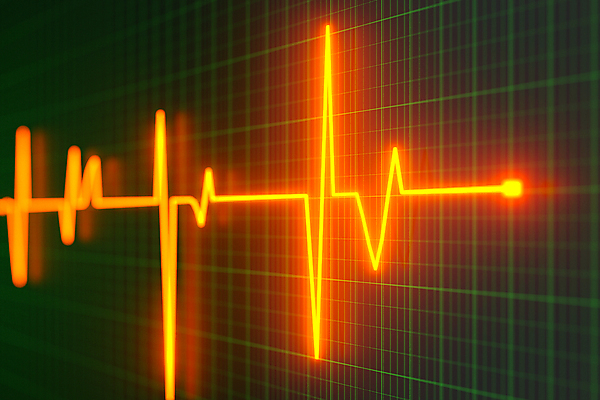 JPG 해외이미지 선 의학 사람없음 3D 검은색 바이탈사인 심전도 심전도모니터 해외포토 포토 컬러 디지털합성 파일형식 이미지허브