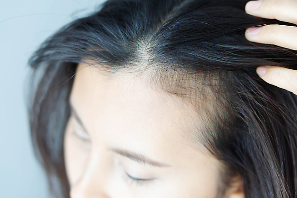 포토 JPG 해외이미지 손 여자 실내 한명 근접촬영 성인 신체부위 뷰티 머리카락 머리 헤어관리 두피관리 두피케어 탈모 탈모클리닉 성인여자한명만 탈모예방 숱 해외포토 1 뷰포인트 사람 내부 예방 클리닉 증상 여자한명만 성인여자만 파일형식 이미지허브