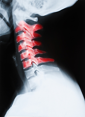 포토 JPG 해외이미지 신체 해부 뼈 골격 엑스레이 건강 병원 사람 사람없음 약 머리 고통 환자 광선 X 척추 목 방사선 해골모형 해외포토 알파벳 감정 의학 신체부위 모형 파일형식 이미지허브