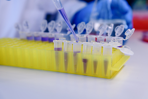 포토 JPG 해외이미지 과학 컨셉 건강 병원 실험 사람없음 스터디 약 장비 작업 액체 실험실 바이러스 질병 DNA 생명공학 플라스틱 약국 과학자 플라스크 분석 생물학 감염 미생물 튜브 발견 조제 혁명 개발 피펫 화학물질 화학자 살균 해외포토 직업 교육 의학 재질 생물 실험기구 학습 화학 만들기 학자 파일형식 이미지허브