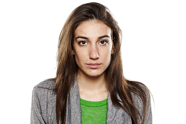 포토 JPG 해외이미지 백인 여자 얼굴 백그라운드 신체 건강 한명 사람 치료 뷰티 약 짜증 피부 감염 문제 여드름 돌봄 사춘기 해외포토 서양인 1 감정 의학 모션 신체부위 파일형식 이미지허브