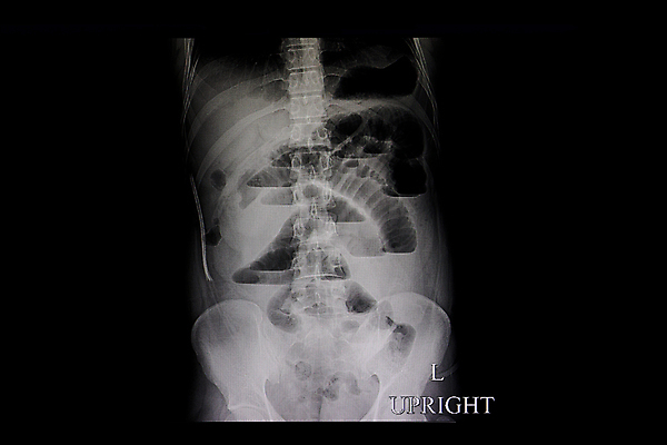 포토 JPG 해외이미지 백그라운드 패턴 신체 사다리 해부 뼈 골격 엑스레이 건강 병원 사람 사람없음 약 고통 환자 의사 광선 흰색 질병 X 작음 큼 필름 위치 가스 단계 거짓말 돌봄 방사선 해외포토 알파벳 감정 컬러 무늬 의학 모션 의료진 도구 크기 파일형식 이미지허브