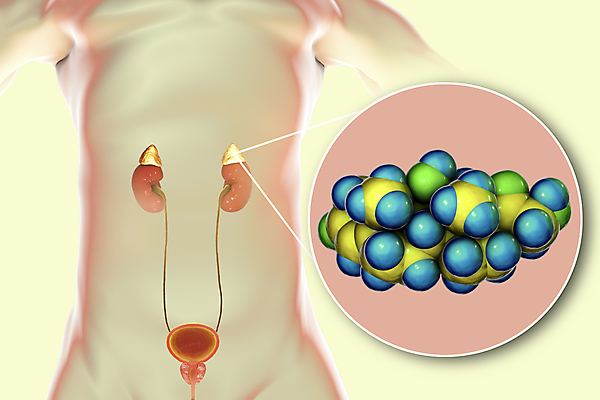 포토 JPG 해외이미지 모델 과학 일러스트 해부 사람없음 치료 약 3D 질병 화학물질 해외일러스트 의학 화학 디지털합성 파일형식 이미지허브