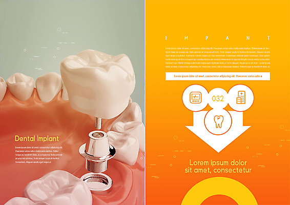 PSD 템플릿 표지디자인 북디자인 출판디자인 화살표 내지 리플렛 북커버 치과 병원 팜플렛 사람없음 치료 주황색 치아 클리닉 치아모형 치과진료 임플란트 잇몸 이미지템플릿 컬러 신체 의학 진료 소화기관 파일형식