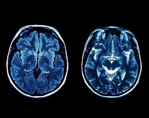 포토 JPG 해외이미지 과학 백그라운드 해부 뼈 엑스레이 건강 병원 사람 사람없음 파란색 약 머리 검은색 기계 시험 환자 광선 흰색 질병 필름 분석 뇌 암 돌봄 방사선 해골모형 해외포토 교육 컬러 컨셉 의학 모션 신체부위 모형 파일형식 이미지허브
