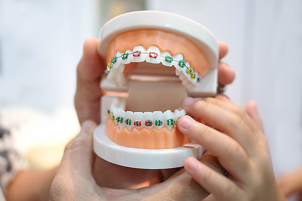 포토 JPG 해외이미지 치과 사람없음 뷰티 치아 부식 치아모형 틀니 교정기 위생관리 치아건강 치아교정 해외포토 건강 병원 관리 소화기관 교정 파일형식 이미지허브