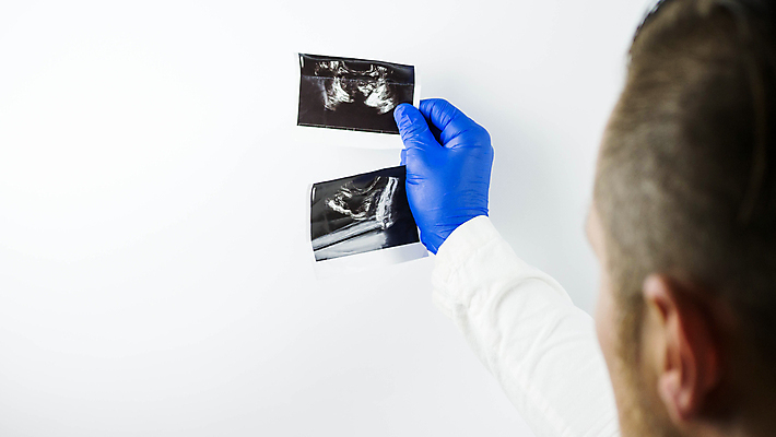 포토 JPG 해외이미지 손 여자 남자 과학 장갑 백그라운드 컨셉 신체 텍스트 해부 청진기 건강 병원 사람없음 그래픽 치료 파란색 알약 약 건강관리 시험 환자 의사 흰색 잡기 신용카드 질병 시스템 보여주기 암 서명 돌봄 염증 해외포토 잡화 교육 컬러 의학 의료기기 모션 관리 사람 신체부위 금융 의료진 파일형식 이미지허브