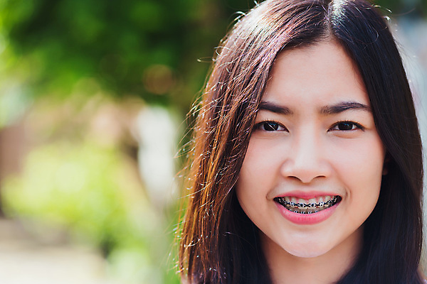 포토 JPG 해외이미지 백인 여자 치과 한명 동양인 성인 야외 뷰티 치아 미녀 치아건강 치아교정 성인여자한명만 해외포토 서양인 1 건강 병원 사람 인종 소화기관 미인 교정 여자한명만 성인여자만 파일형식 이미지허브