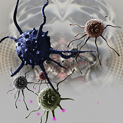 포토 JPG 해외이미지 의학 세포 사람없음 3D 회색 질병 디지털합성 암 갈비뼈 종양 해외포토 컬러 뼈 파일형식 이미지허브
