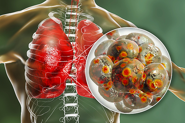 포토 JPG 해외이미지 과학 신체 일러스트 해부 현미경 사람 사람없음 글로벌 약 3D 중국 호흡기관 바이러스 질병 감염 테라피 백신 염증 전염병 사스 해외일러스트 아시아 의학 실험기구 뷰티 장기_의학 디지털합성 파일형식 이미지허브