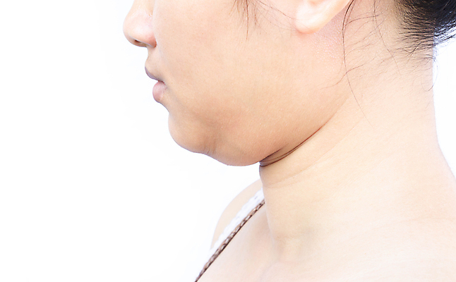 포토 JPG 해외이미지 모양 백인 라이프스타일 여자 얼굴 컨셉 신체 다이어트 건강 한명 사람 뷰티 머리 흰색 플라스틱 비만 피부 목 주사약 외과 턱 고립 더블 돌봄 전후 셀룰라이트 해외포토 서양인 1 컬러 의학 모션 재질 병원 생활 신체부위 약 비교 몸매 파일형식 이미지허브