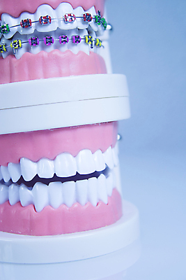 포토 JPG 해외이미지 치과 사람없음 치아 치아모형 틀니 교정기 위생관리 치아건강 치아교정 해외포토 건강 병원 관리 소화기관 교정 파일형식 이미지허브