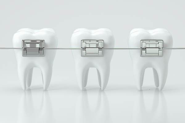 JPG 해외이미지 의학 사람없음 3D 흰색 치아 연결 교정기 치아건강 치아교정 해외포토 포토 컬러 건강 소화기관 디지털합성 교정 파일형식 이미지허브