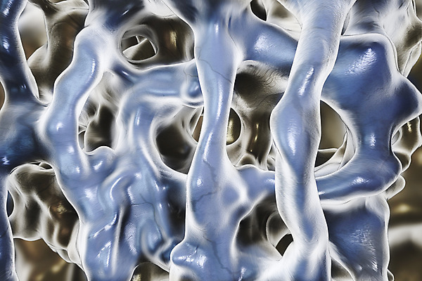 포토 JPG 해외이미지 일러스트 뼈 골격 현미경 사람없음 컬러풀 약 3D 질병 척추 골다공증 현실 해외일러스트 컬러 의학 실험기구 디지털합성 파일형식 이미지허브