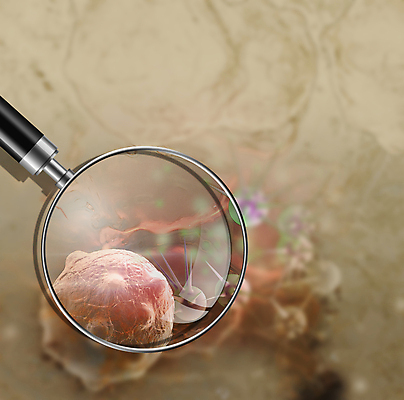 포토 JPG 해외이미지 의학 돋보기 세포 사람없음 3D 질병 디지털합성 암 베이지색 종양 해외포토 컬러 파일형식 이미지허브