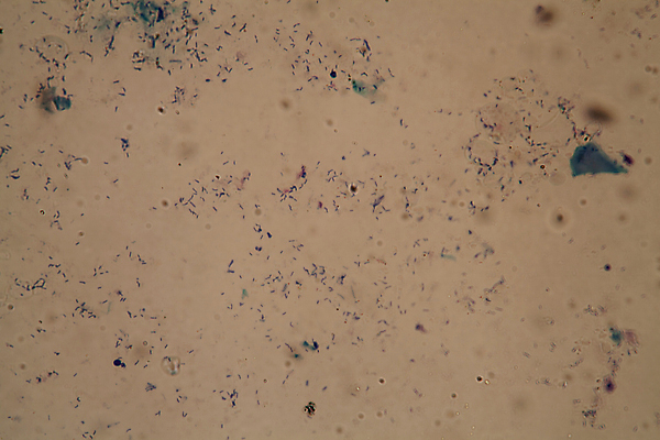 포토 JPG 해외이미지 과학 사람없음 위험 감염 박테리아 해외포토 컨셉 의학 파일형식 이미지허브