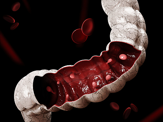 포토 JPG 해외이미지 과학 신체 일러스트 부분 해부 세포 건강 사람 사람없음 그래픽 치료 약 환자 막대기 오르간 유연 그림 생물학 시스템 섬유 암 외과 테라피 삭제 방사선 종양 가상 해외일러스트 교육 의학 병원 뷰티 직물 건반악기 질병 파일형식 이미지허브