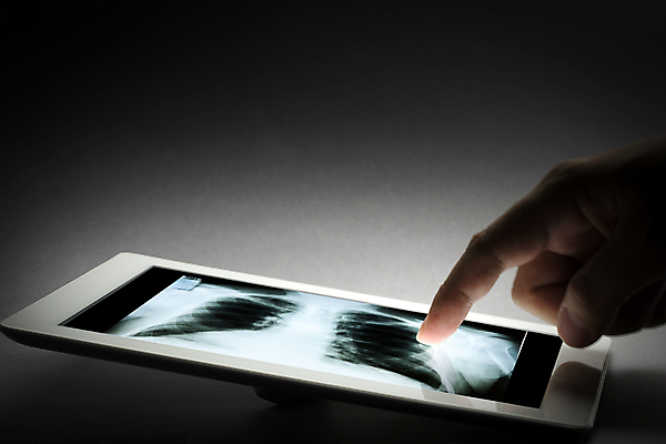 포토 JPG 해외이미지 손 신체 뼈 엑스레이 건강 병원 사람 사람없음 컴퓨터 알약 약 머리 스크린 고통 환자 의사 광선 치아 X 사건 척추 치과의사 두통 목 문제 긴장 턱 깨짐 방사선 압력 해골모형 해외포토 알파벳 감정 컨셉 의학 신체부위 전자제품 모형 의료진 소화기관 질병 파일형식 이미지허브