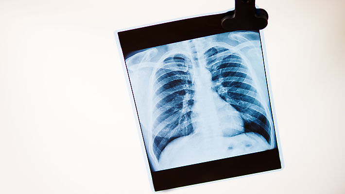 포토 JPG 해외이미지 응시 인터넷 비즈니스 해부 뼈 프레임 엑스레이 건강 병원 사람없음 노트북 컴퓨터 알약 3D 건강관리 디지털 스크린 진료 장비 시험 의사 흰색 도움 실험실 질병 토론 필름 오브젝트 확인 암 고립 골절 궤 돌봄 심장병 해외포토 시선 교육 컬러 컨셉 의학 모션 실험 관리 전자제품 약 의료진 디지털합성 파일형식 이미지허브