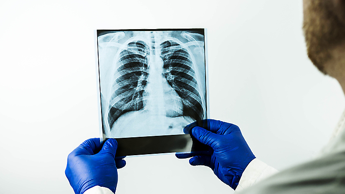 포토 JPG 해외이미지 직업 응시 여자 유니폼 해부 청진기 엑스레이 건강 병원 사람 사람없음 치료 약 건강관리 진료 시험 환자 의사 광선 흰색 실험실 질병 분석 뇌 암 외과 돌봄 방사선 해외포토 시선 옷 교육 컬러 컨셉 의학 의료기기 모션 실험 관리 의료진 파일형식 이미지허브