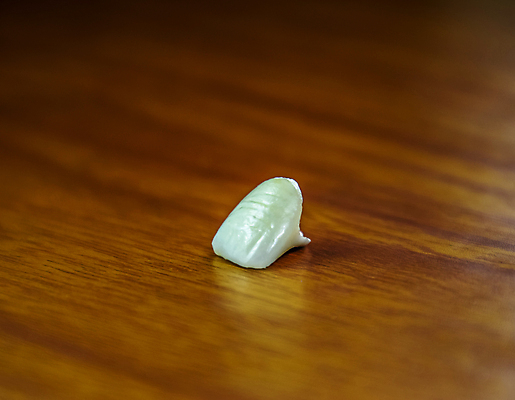 포토 JPG 해외이미지 직업 남자 탁자 왕관 건강 웃음 사람없음 치료 빛 약 금속 시험 의사 흰색 오픈 입 구멍 치아 상처 작음 혀 피부 부식 시멘트 틀니 교체 땅바닥 명패 잇몸 합판 해외포토 교육 컬러 가구 신체 의학 재질 바닥 표정 사람 신체부위 의료진 소화기관 크기 파일형식 이미지허브