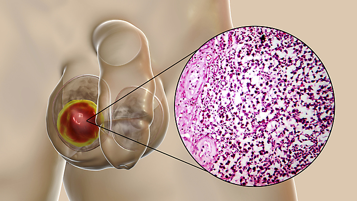 포토 JPG 해외이미지 남자 신체 일러스트 해부 현미경 사람없음 약 3D 얼룩 조직 변화 확대 질병 암 박테리아 종양 해외일러스트 컨셉 의학 실험기구 사람 디지털합성 파일형식 이미지허브