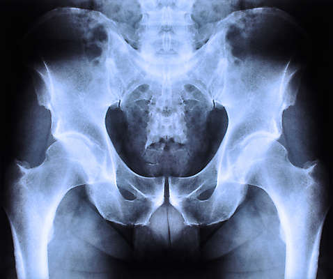 포토 JPG 해외이미지 신체 해부 뼈 골격 엑스레이 건강 병원 사람 사람없음 약 고통 시험 환자 광선 투명 실험실 X 필름 그림 깨짐 방사선 해외포토 알파벳 교육 감정 컨셉 의학 실험 파일형식 이미지허브