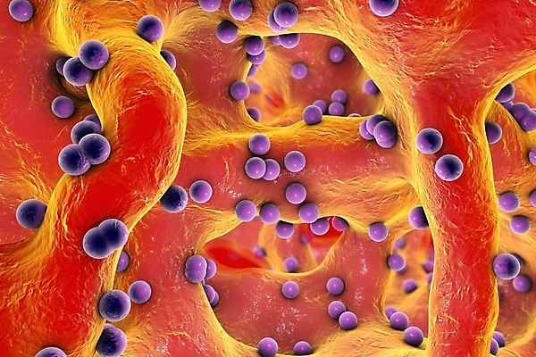 포토 JPG 해외이미지 과학 백그라운드 일러스트 뼈 세포 건강 현미경 사람 사람없음 약 3D 고통 열 바이러스 닫기 질병 공격 생물학 싸움 감염 미생물 박테리아 전염병 해외일러스트 교육 감정 의학 모션 생물 실험기구 디지털합성 파일형식 이미지허브