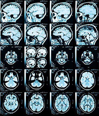 포토 JPG 해외이미지 남자 얼굴 신체 해부 뼈 골격 엑스레이 건강 병원 사람 사람없음 치료 스터디 약 머리 방 고통 환자 수술 질병 필름 뇌 두통 외과 동맥 원자력 방사선 해골모형 해외포토 감정 의학 신체부위 학습 모형 에너지 혈관 파일형식 이미지허브
