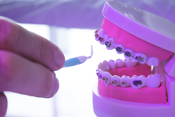 포토 JPG 해외이미지 손가락 치과 신체부위 치아 치아모형 틀니 교정기 위생관리 치아건강 치아교정 해외포토 손 건강 병원 관리 사람 소화기관 교정 파일형식 이미지허브