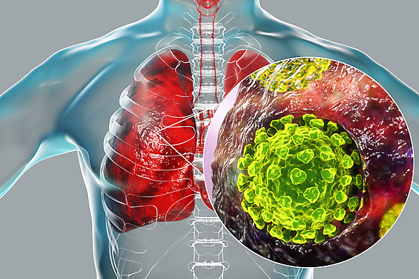 포토 JPG 해외이미지 과학 신체 일러스트 해부 현미경 사람 사람없음 글로벌 약 3D 중국 호흡기관 바이러스 질병 감염 테라피 백신 염증 전염병 사스 해외일러스트 아시아 의학 실험기구 뷰티 장기_의학 디지털합성 파일형식 이미지허브