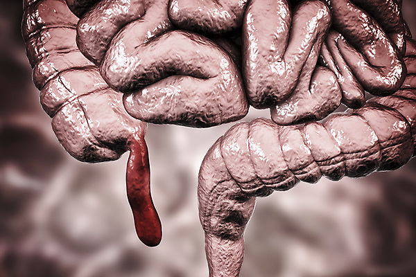 포토 JPG 해외이미지 남자 과학 컨셉 신체 일러스트 해부 건강 사람 사람없음 내부 약 3D 고통 오르간 닫기 질병 생물학 시스템 돌봄 복근 염증 증상 해외일러스트 교육 감정 의학 모션 근육 건반악기 디지털합성 파일형식 이미지허브